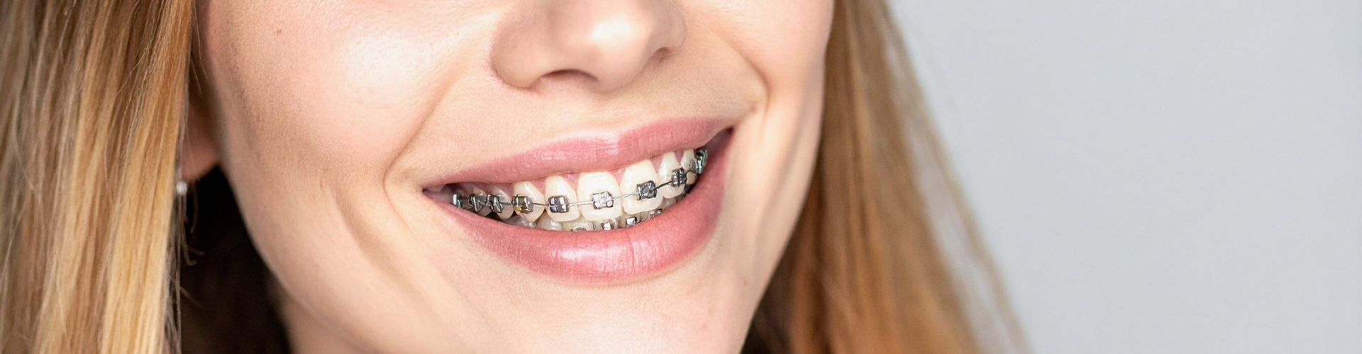 Smiling girl with braces.